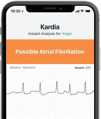  KardiaMobile 1-Lead Personal EKG Monitor – Record EKGs at Home  – Detects AFib and Irregular Arrhythmias – Instant Results in 30 Seconds –  Easy to Use – Works with Most