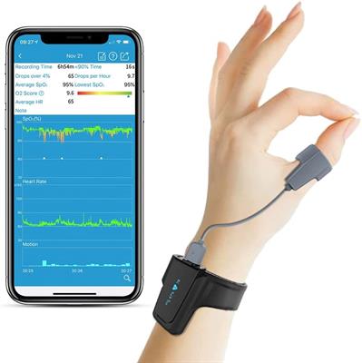 Wellue Checkme 02 Pro Bluetooth Oxygen Saturation Monitor