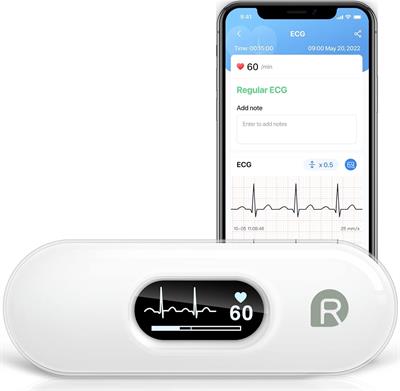 Wellue DUOEK-S Personal EKG Monitor Record ECG and Heart Rate to Fully Understand Heart Health | Works with iOS & Android Smartphones