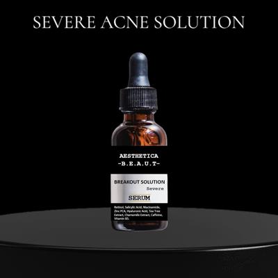 Breakout Solution Severe Serum